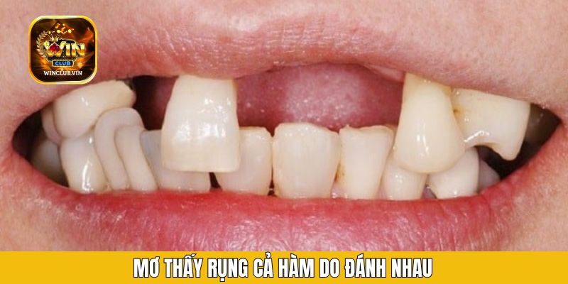 Mơ thấy rụng cả hàm do đánh nhau